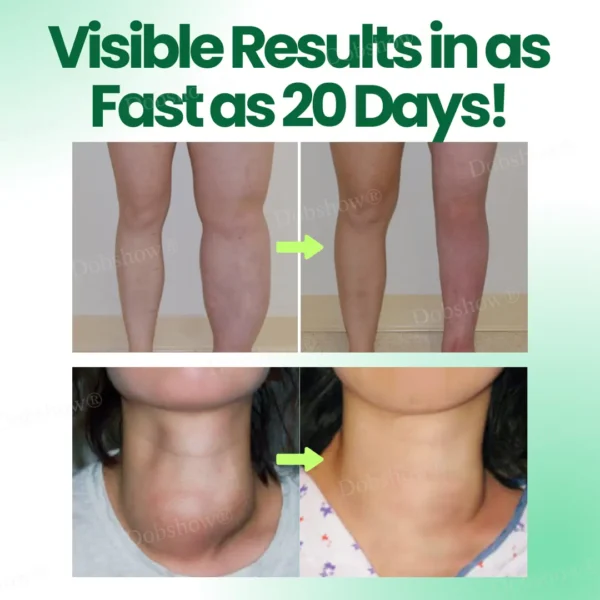 Dobshow® Lymphatic Detox Herbal Cream